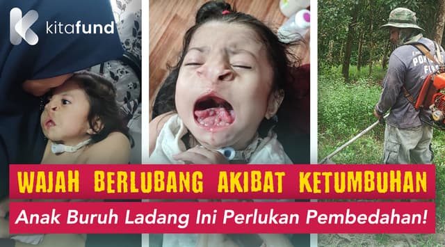 URGENT! Adik Iman Perlukan Pembedahan Segera!